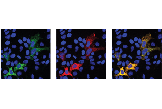 Immunofluorescence Image 1: AsCpf1/Cas12a (Strain <i>BV3L6</i>) (E1U7C) Rabbit mAb (BSA and Azide Free)