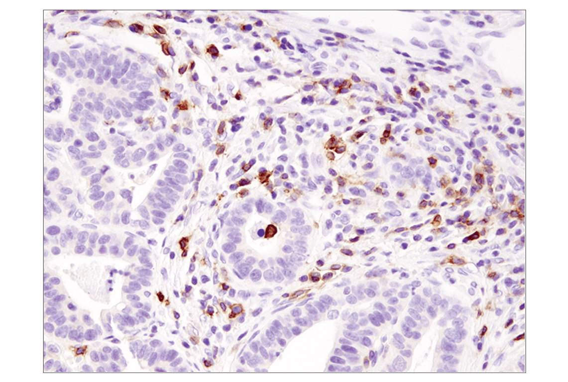 Immunohistochemistry Image 2: ICOS (D1K2T) Rabbit Monoclonal Antibody