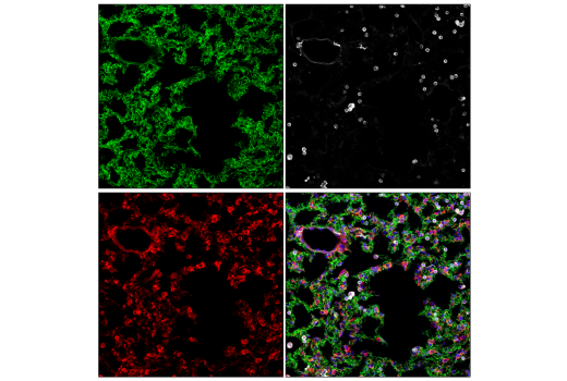 Immunofluorescence Image 1: Paxillin (E6R6Z) Rabbit Monoclonal Antibody