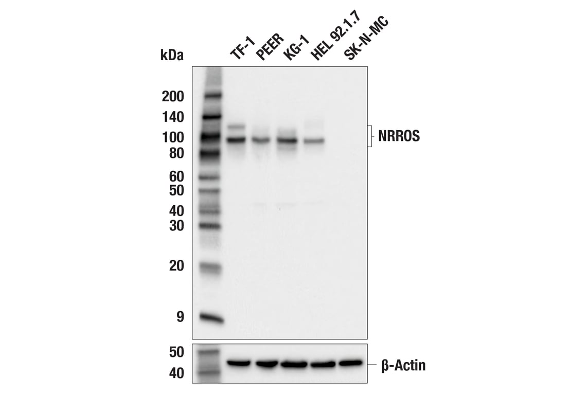 Western Blotting Image 2: NRROS (E7Q2J) Rabbit Monoclonal Antibody