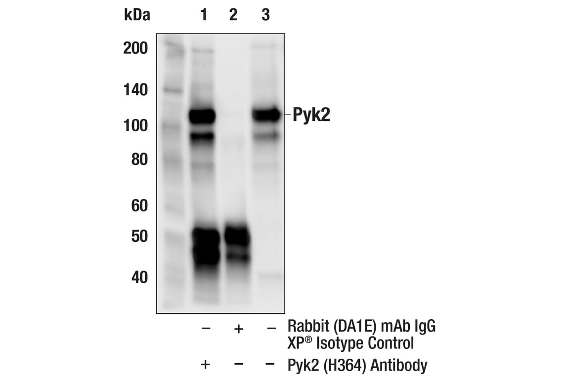 Immunoprecipitation Image 1: Pyk2 (H364) Antibody