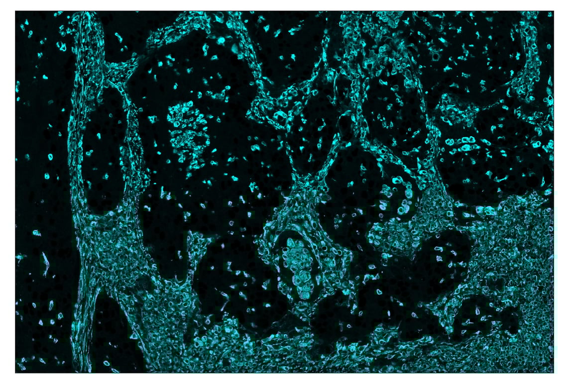 Immunohistochemistry Image 5: Vimentin (D21H3) & CO-0012-488 SignalStar<sup>™</sup> Oligo-Antibody Pair