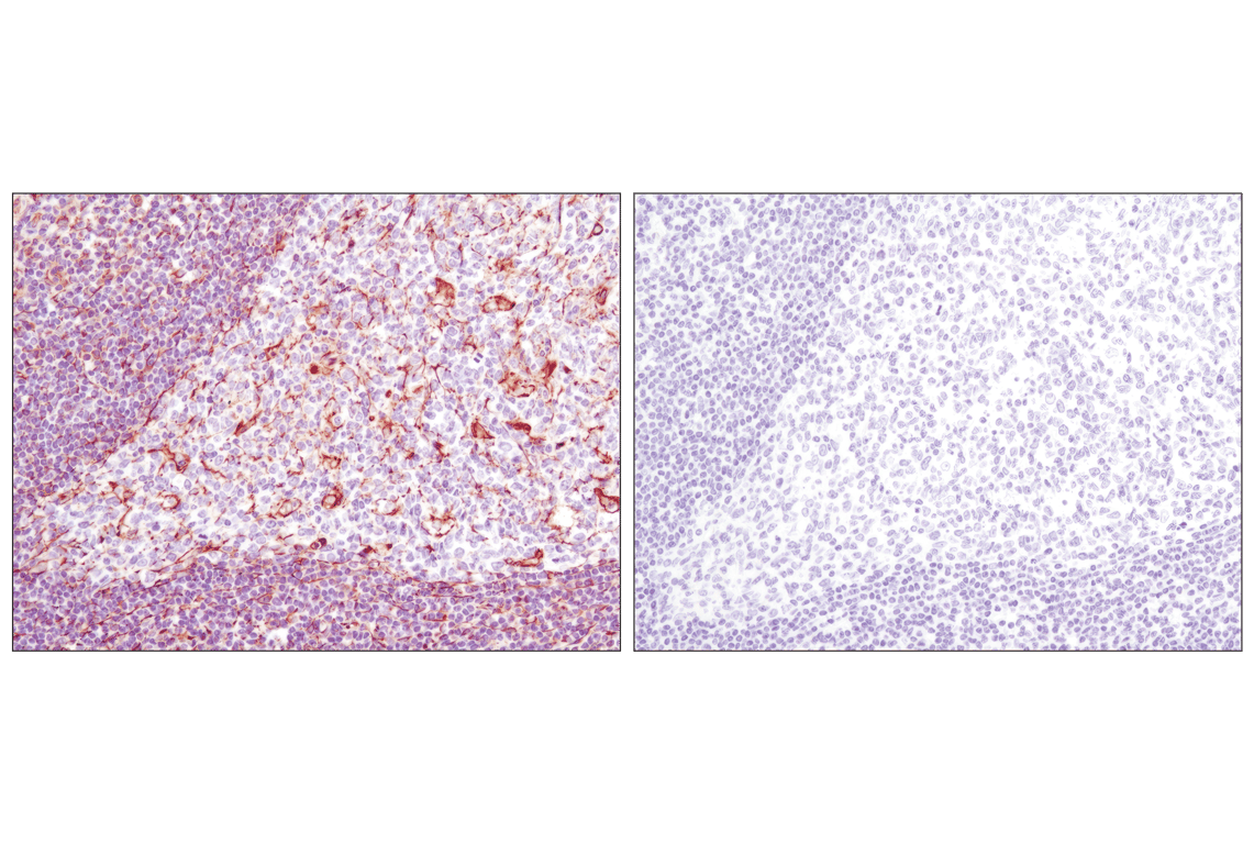Immunohistochemistry Image 6: Vimentin (D21H3) Rabbit Monoclonal Antibody (BSA and Azide Free)