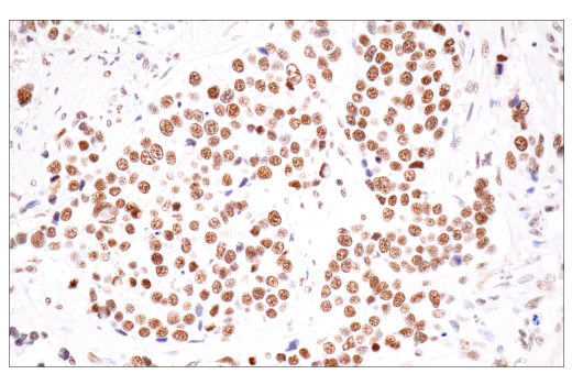 Immunohistochemistry Image 1: CPSF4 (E2L2Z) Rabbit Monoclonal Antibody