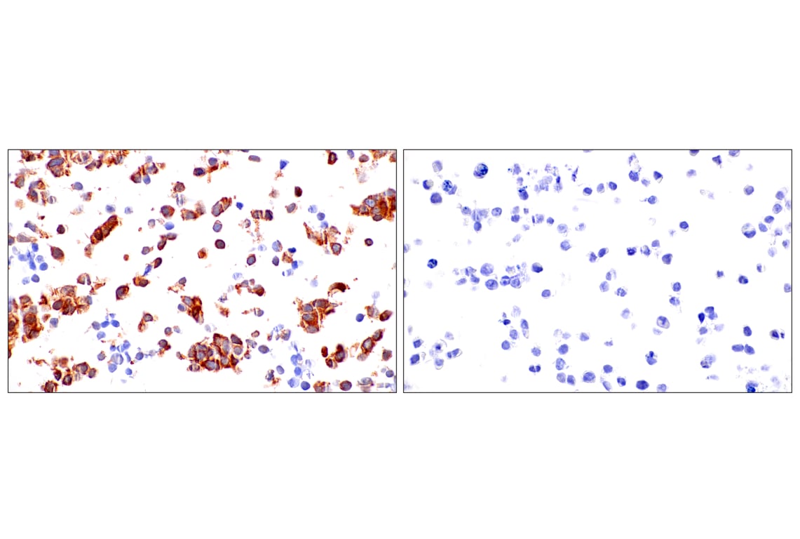 Immunohistochemistry Image 14: Phospho-YAP (Ser61) (E4Q8S) Rabbit Monoclonal Antibody