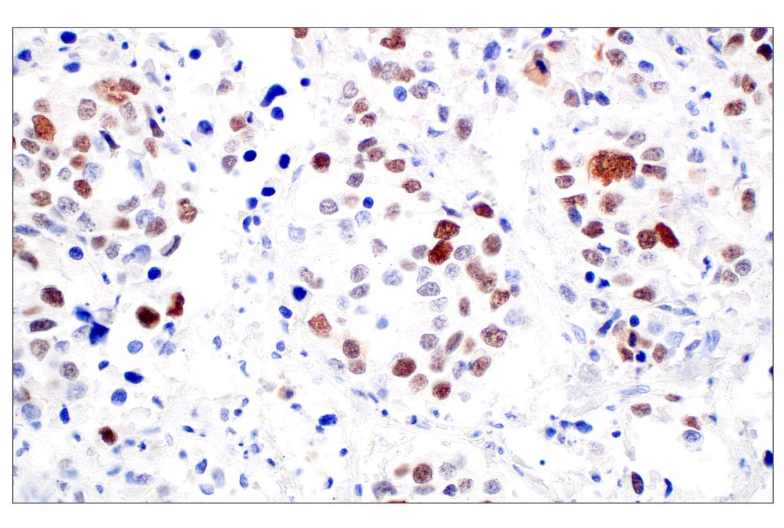 Immunohistochemistry Image 5: BRCA1 (E5S9G) Rabbit Monoclonal Antibody