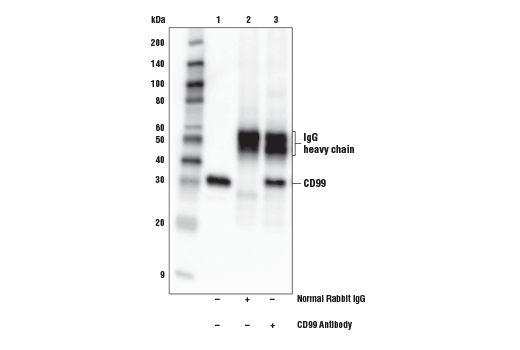 Immunoprecipitation Image 1: CD99 Antibody