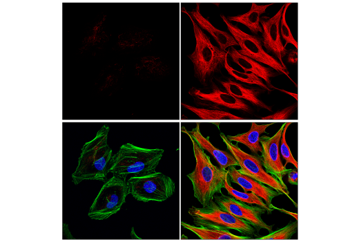 Acetyl-α-Tubulin (Lys40) (D20G3) XP® Rabbit mAb (Alexa Fluor Acetyl-α-Tubulin (Lys40) (D20G3) XP® Rabbit mAb (Alexa Fluor