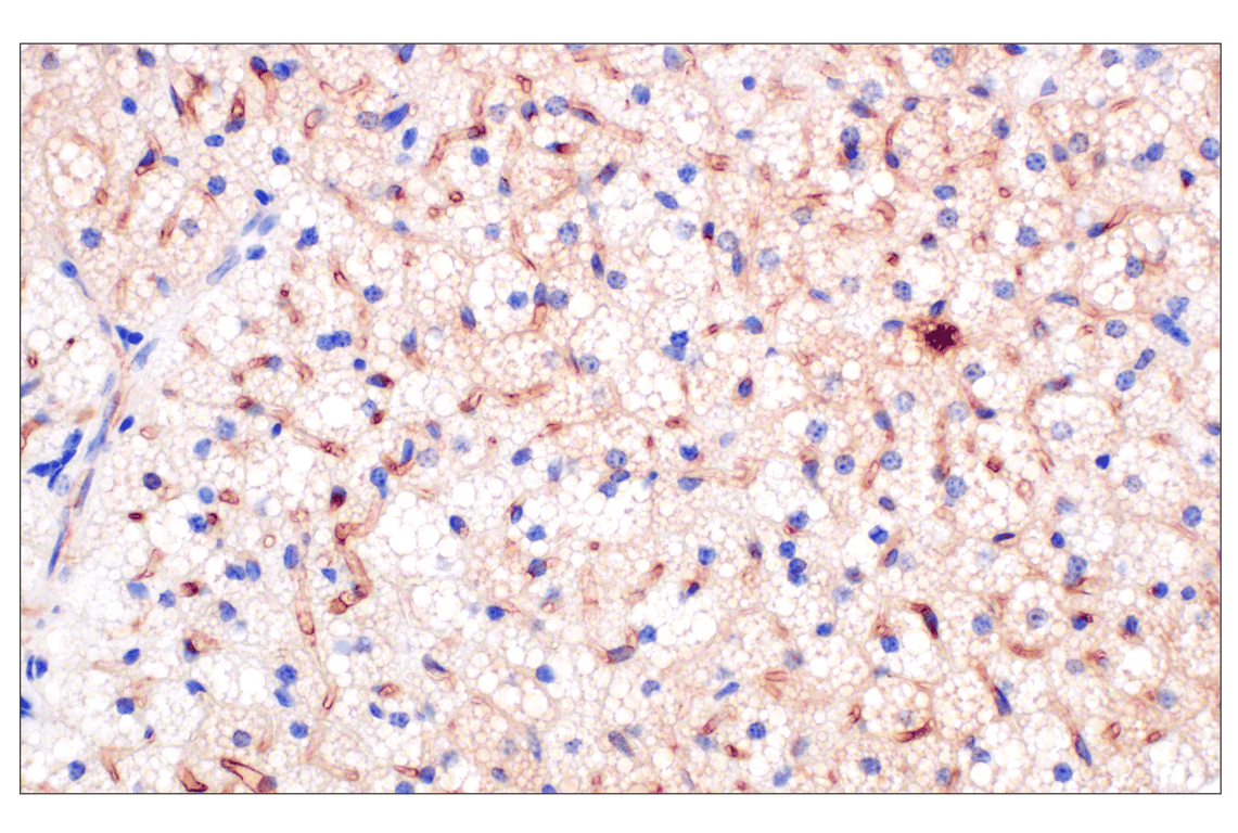 Immunohistochemistry Image 2: PNPLA3 (E7N6O) Rabbit Monoclonal Antibody (BSA and Azide Free)