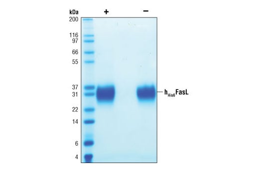 undefined Image 2: Human <sub>His6</sub>Fas Ligand/TNFSF6 (h<sub>His6</sub>FasL)