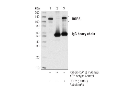 Immunoprecipitation Image 1: ROR2 (D3B6F) Rabbit Monoclonal Antibody