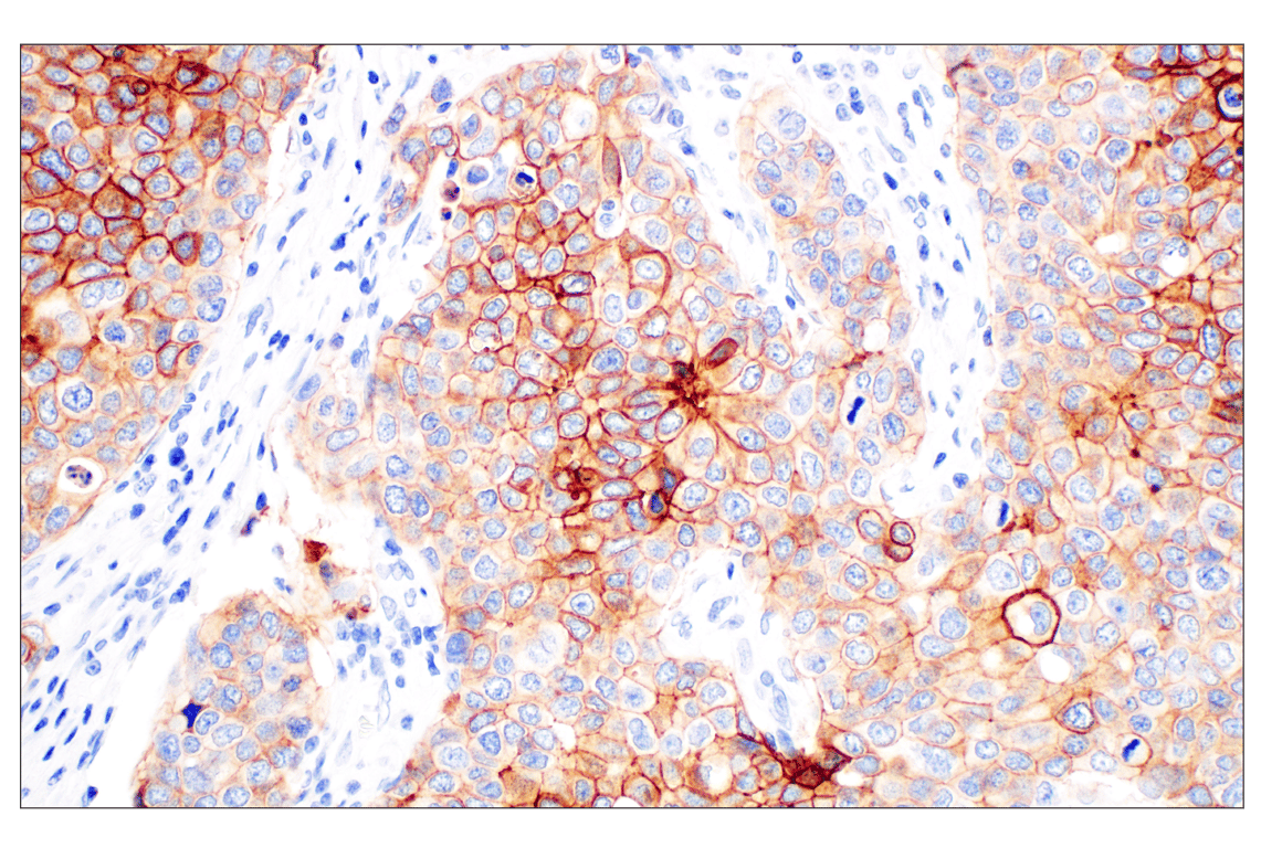 Immunohistochemistry Image 1: TACSTD2/TROP2 (F4W4J) Rabbit Monoclonal Antibody