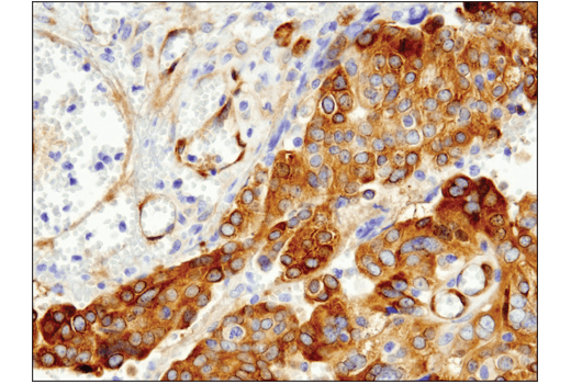 Immunohistochemistry Image 1: FAK (D5O7U) Rabbit Monoclonal Antibody (BSA and Azide Free)
