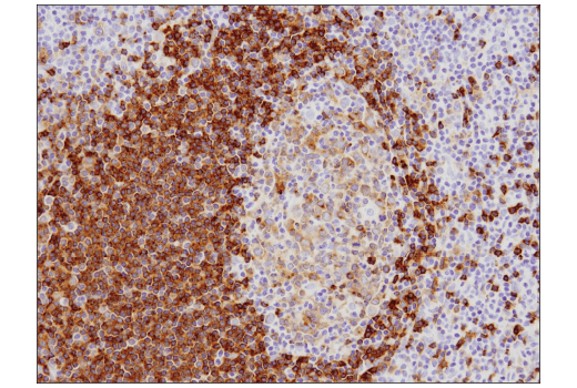 Immunohistochemistry Image 2: CD79B (D7V2F) Rabbit Monoclonal Antibody