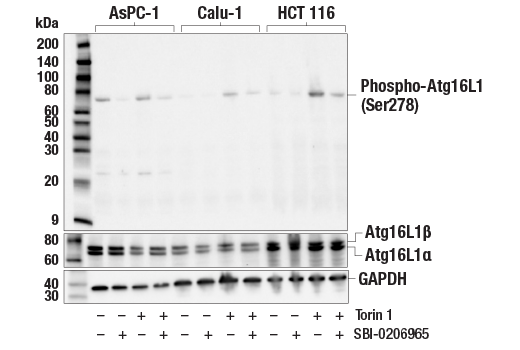 undefined Image 1: PhosphoPlus<sup>®</sup> Atg16L1 (Ser278) Antibody Duet