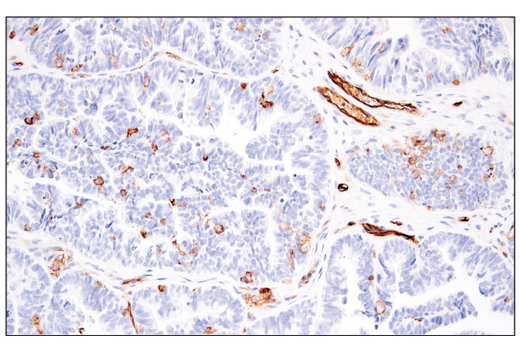 Immunohistochemistry Image 4: CD141/Thrombomodulin (E7Y9P) Rabbit Monoclonal Antibody