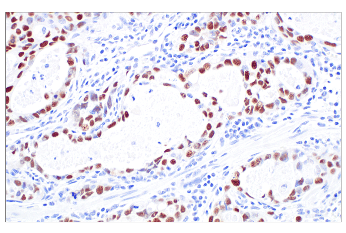 Immunohistochemistry Image 1: CT45 (F7S2I) Rabbit Monoclonal Antibody