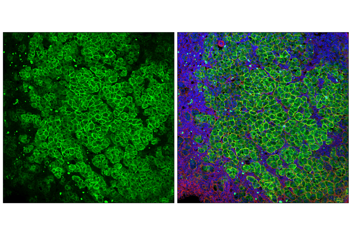 Immunofluorescence Image 1: SCARB1 (E9H4F) Rabbit Monoclonal Antibody