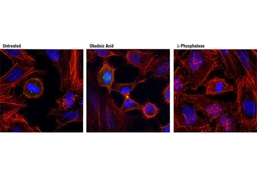 Immunofluorescence Image 1: Phospho-LATS1 (Thr1079) Antibody