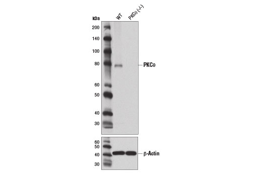 Western Blotting Image 1: PKCθ (E1I7Y) Rabbit mAb