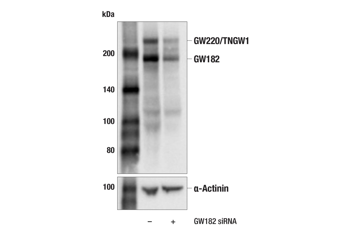 Western Blotting Image 2: GW182 (E4C7J) Rabbit Monoclonal Antibody