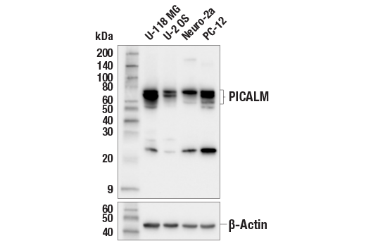 undefined Image 1: PICALM Signaling Antibody Sampler Kit