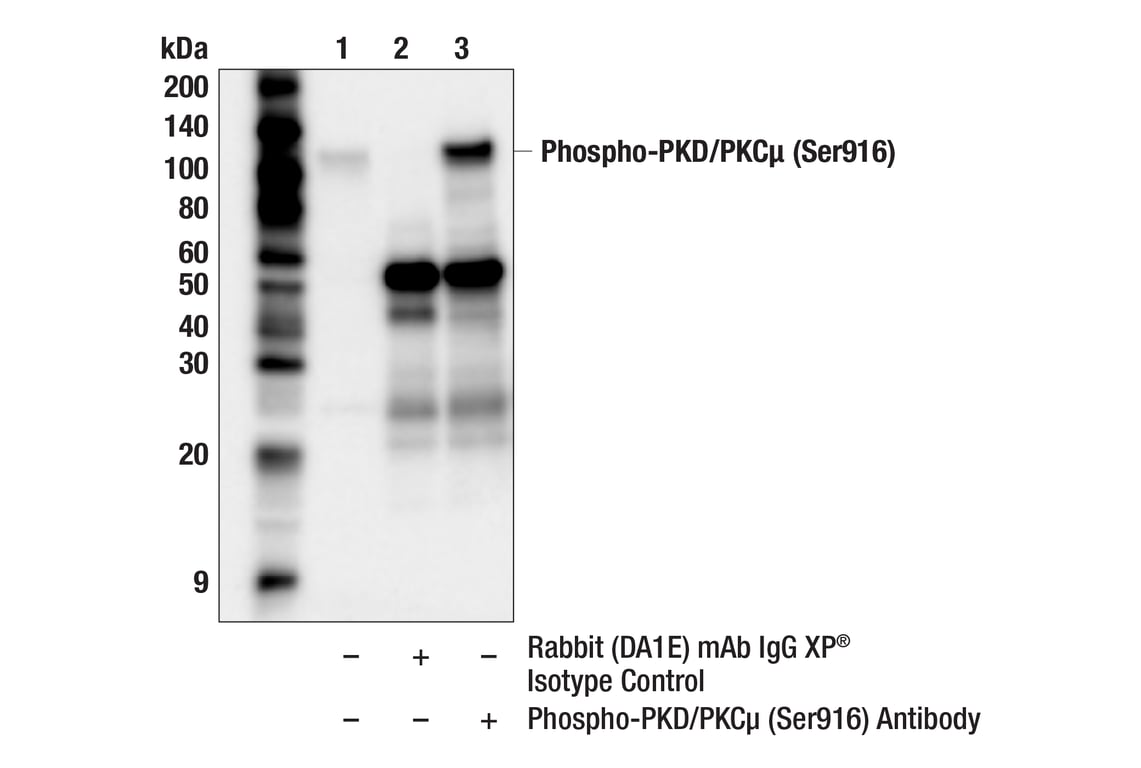 undefined Image 19: Phospho-PKC Antibody Sampler Kit