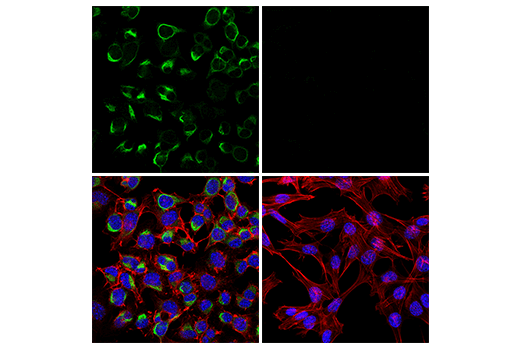 Immunofluorescence Image 1: Neurofilament-H Antibody