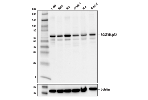 Western Blotting Image 3: SQSTM1/p62 (D6M5X) Rabbit Monoclonal Antibody