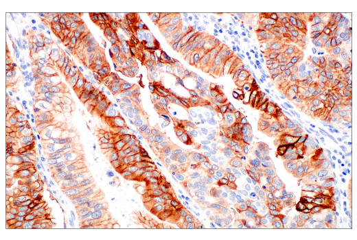 Immunohistochemistry Image 3: Integrin beta6 (E4M9P) Rabbit Monoclonal Antibody