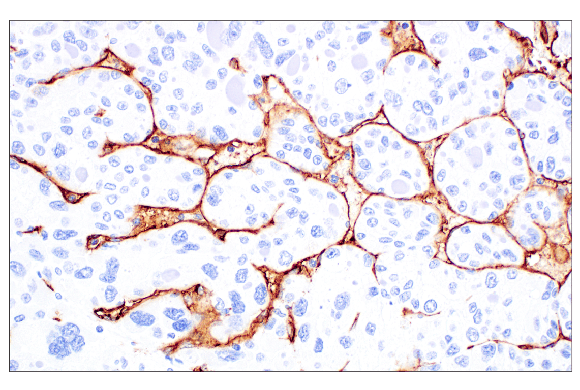 Immunohistochemistry Image 3: CD34 (QBEND/10) Mouse Monoclonal Antibody