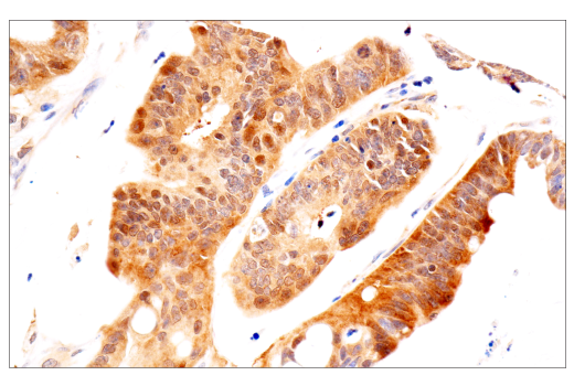 Immunohistochemistry Image 2: VHL (E3X9K) Rabbit Monoclonal Antibody (BSA and Azide Free)