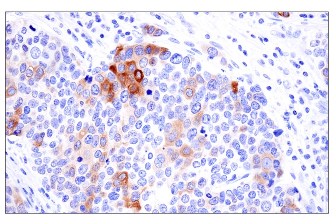 Immunohistochemistry Image 6: Phospho-Tau (Ser396) (F3S9T) Rabbit Monoclonal Antibody
