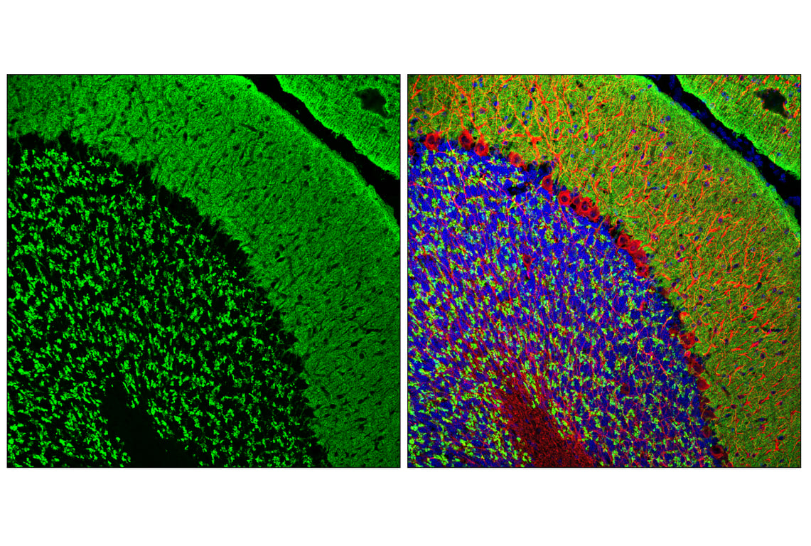Immunofluorescence Image 1: VGLUT1 (E8L5B) Rabbit Monoclonal Antibody