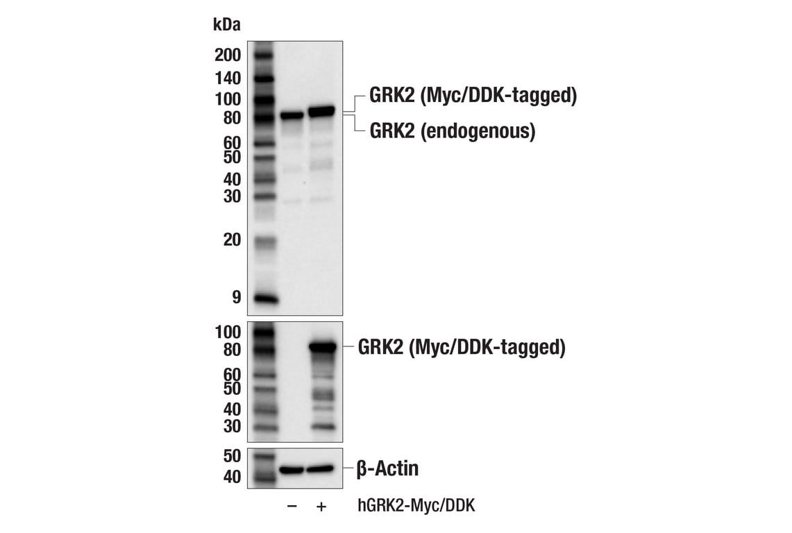 Western Blotting Image 3: GRK2 (E8A7E) Rabbit Monoclonal Antibody