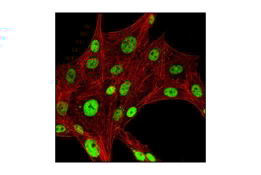 Immunofluorescence Image 1: CREB (D76D11) Rabbit Monoclonal Antibody