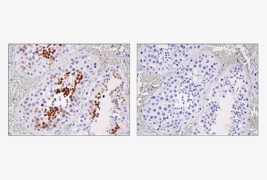 Immunohistochemistry Image 2: IL-13RA2/CD213a2 (E7U7B) Rabbit Monoclonal Antibody (BSA and Azide Free)