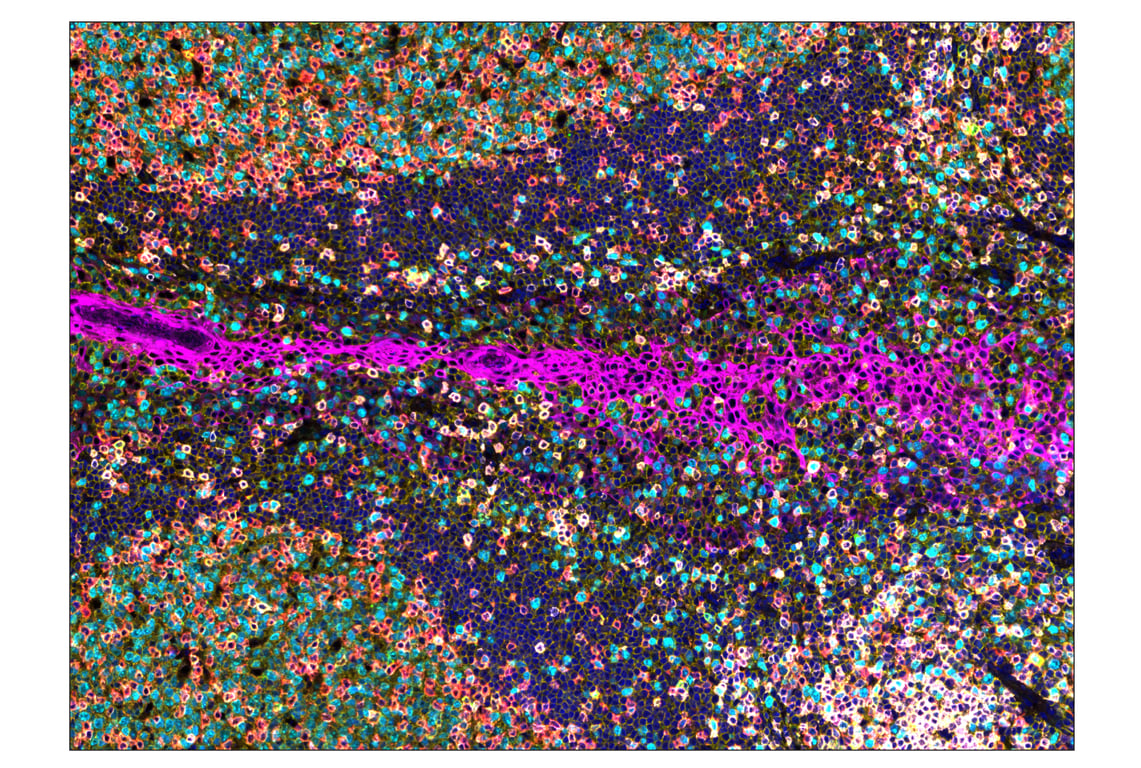 Immunohistochemistry Image 1: CD20 (E7B7T) & CO-0011-594 SignalStar<sup>™</sup> Oligo-Antibody Pair