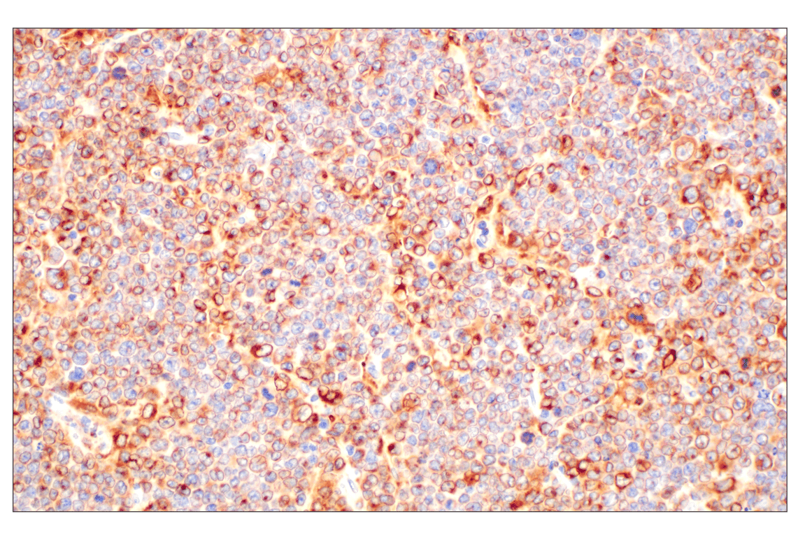 Immunohistochemistry Image 1: CD74 (F3R3L) Rabbit Monoclonal Antibody