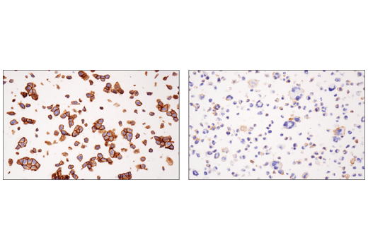 Immunohistochemistry Image 4: Nectin-2/CD112 (D8D3F) Rabbit Monoclonal Antibody