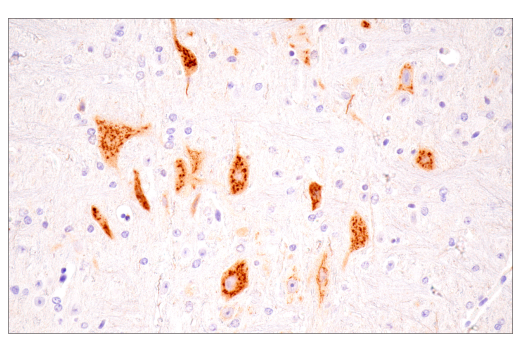 Immunohistochemistry Image 3: Osteopontin/SPP1 (E9Z1D) Rabbit Monoclonal Antibody (BSA and Azide Free)