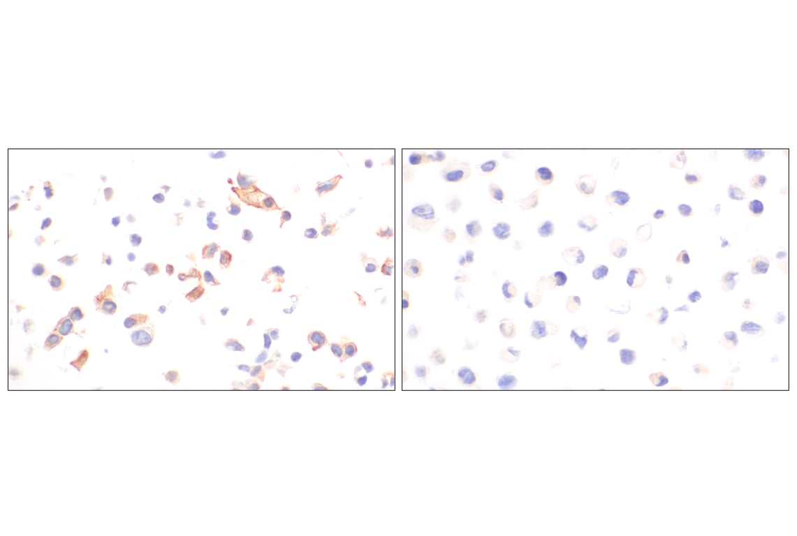 Immunohistochemistry Image 9: OLR1/LOX1 (E9C5A) Rabbit Monoclonal Antibody (BSA and Azide Free)