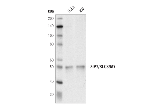 Western Blotting Image 1: ZIP7/SLC39A7 (D1O3A) Rabbit mAb