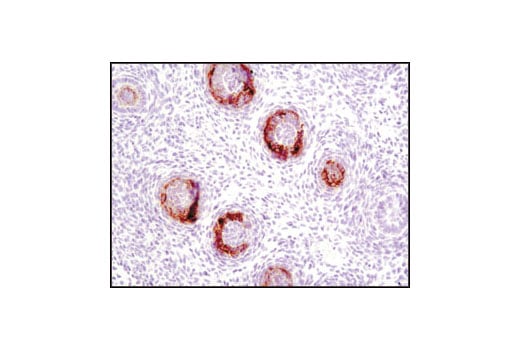 undefined Image 70: Suppressive Myeloid Cell Phenotyping IHC Antibody Sampler Kit