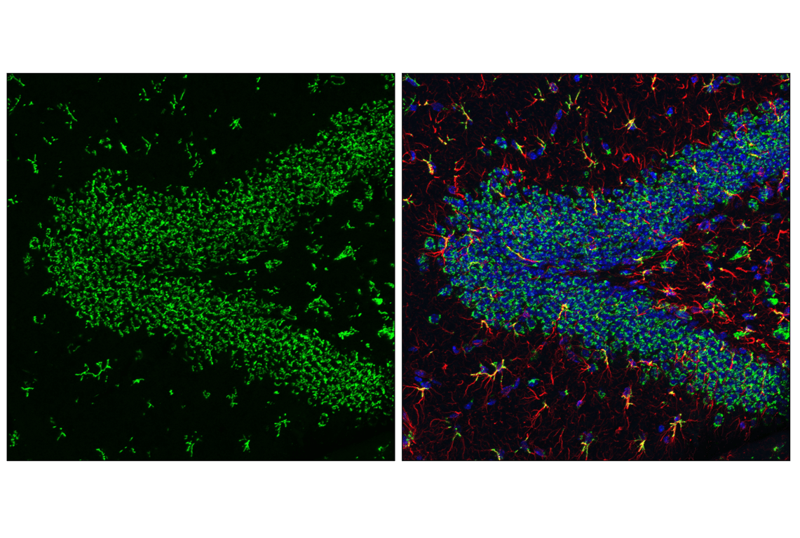 Immunofluorescence Image 5: GM130 (E9Z6S) Rabbit Monoclonal Antibody