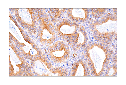 Immunohistochemistry Image 1: Tapasin (E6P2Z) Rabbit Monoclonal Antibody (BSA and Azide Free)