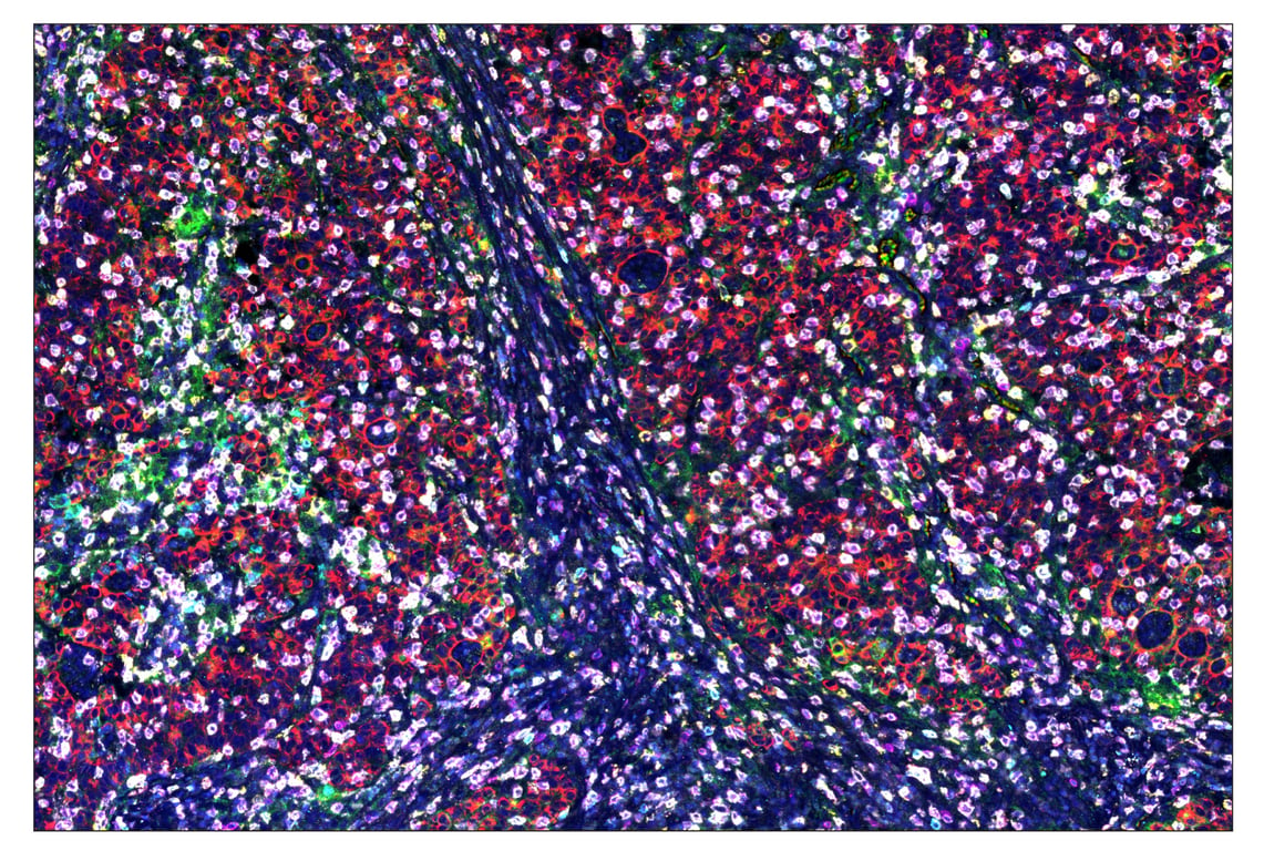Immunohistochemistry Image 1: CD3ε (D7A6E<sup>™</sup>) & CO-0001-647 SignalStar<sup>™</sup> Oligo-Antibody Pair