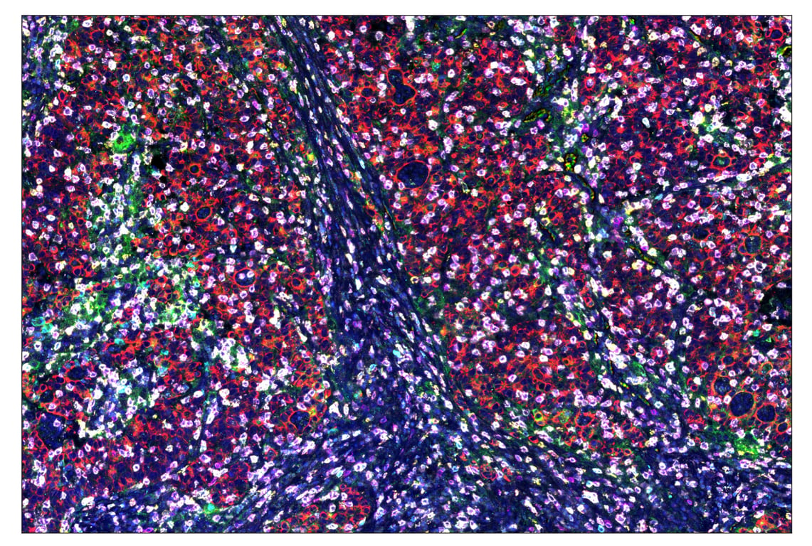 Immunohistochemistry Image 1: CD3ε (D7A6E<sup>™</sup>) & CO-0001-594 SignalStar<sup>™</sup> Oligo-Antibody Pair