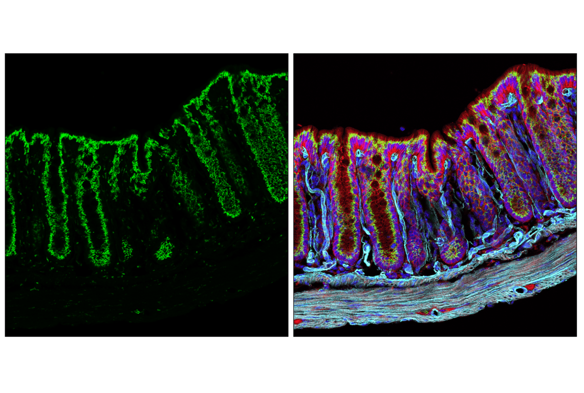 Immunofluorescence Image 2: GM130 (E9Z6S) Rabbit Monoclonal Antibody