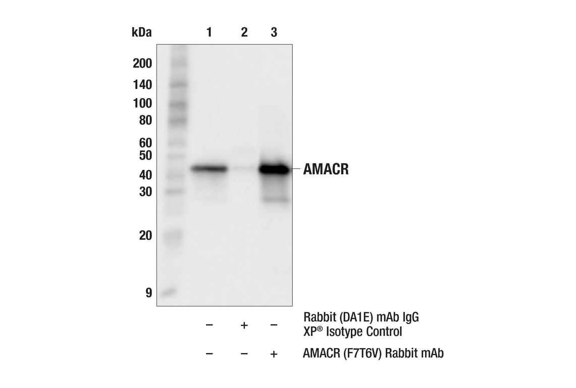 Immunoprecipitation Image 1: AMACR (F7T6V) Rabbit Monoclonal Antibody